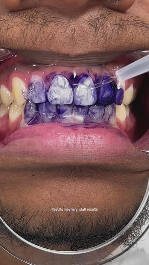 Hismile - Teeth Brightening Serum V34